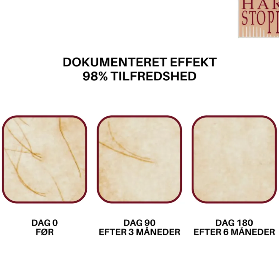 New HårStopp Ansigt, 15 ml